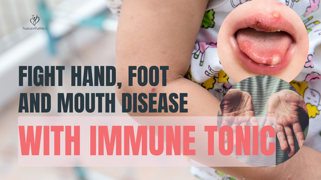 Heal Hand, foot, and mouth (HFMD) with Homeopathy Homeopathy Brisbane