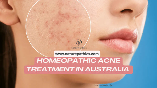 Homeopathy remedy for acne, Homeopathy medicine for acne, Homeopathy medicine for pimples, blemishes and scar. Homeopathy pharmacy online delivery all over Australia. Best Homeopath near me. Best Homeopathy online. Best Homeopathy pharmacy. 