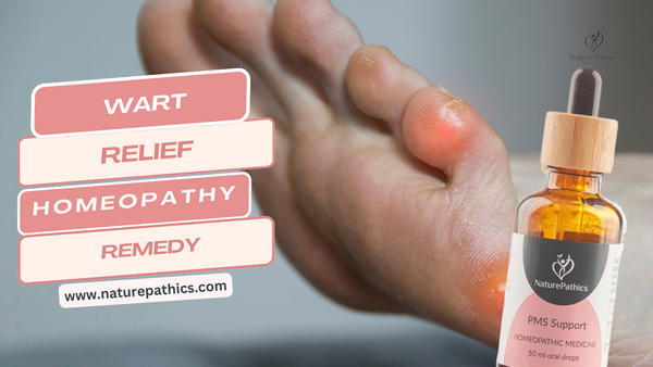 Homeopathy Wart Relief: Supporting Natural Healing with NaturePathics in Australia