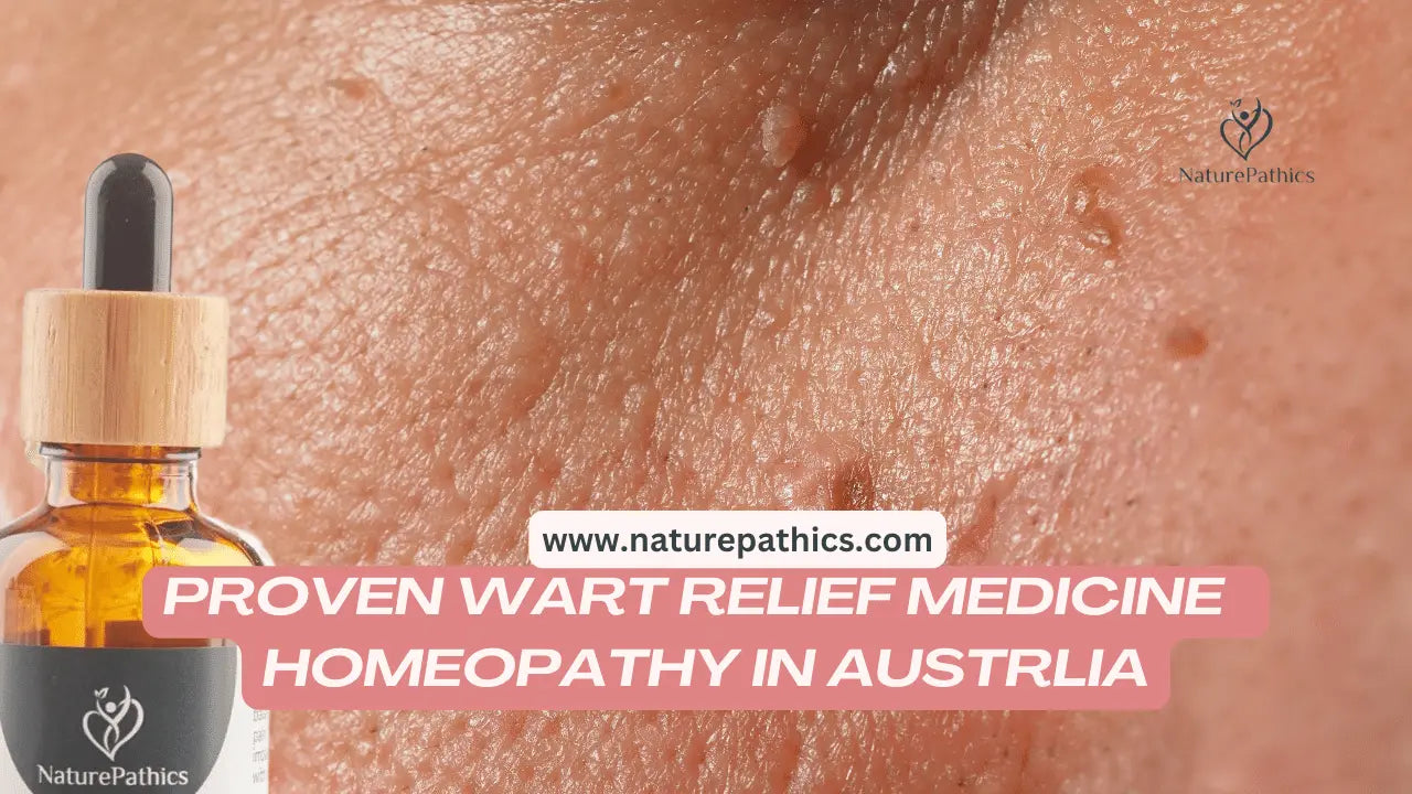 Homeopathy Wart medicine | Homeopathy remedy for Wart in Australia